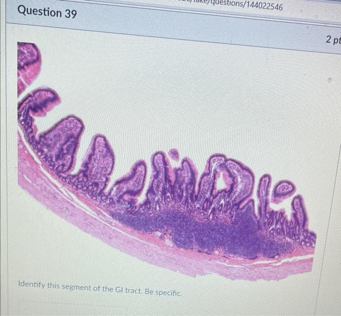 Question 39 Identify This Segment Of The Gi Tract Be Specific Ons 144022546 2 Pt 0900 Identify The Specific Structure 1