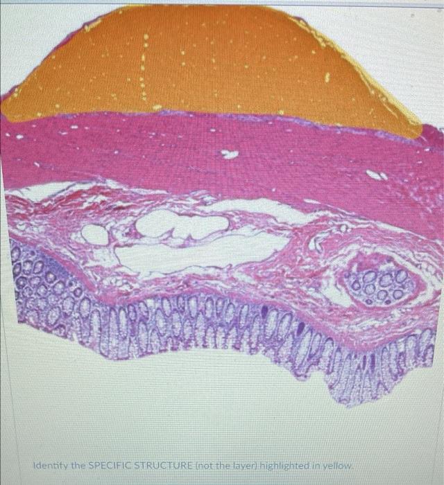 Question 39 Identify This Segment Of The Gi Tract Be Specific Ons 144022546 2 Pt 0900 Identify The Specific Structure 2