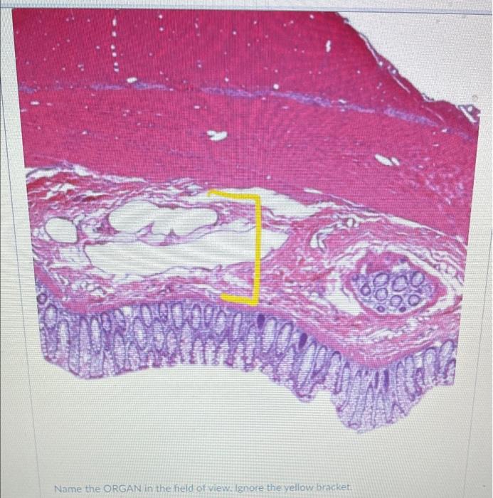 Question 39 Identify This Segment Of The Gi Tract Be Specific Ons 144022546 2 Pt 0900 Identify The Specific Structure 3