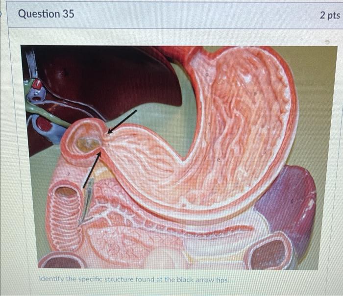 Question 35 Be Identify The Specific Structure Found At The Black Arrow Tips 2 Pts Question 32 Identify The Structures 1