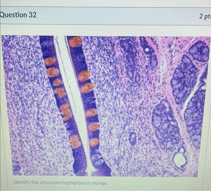Question 35 Be Identify The Specific Structure Found At The Black Arrow Tips 2 Pts Question 32 Identify The Structures 2