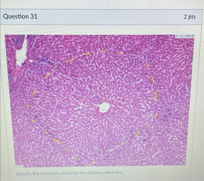 Question 35 Be Identify The Specific Structure Found At The Black Arrow Tips 2 Pts Question 32 Identify The Structures 3