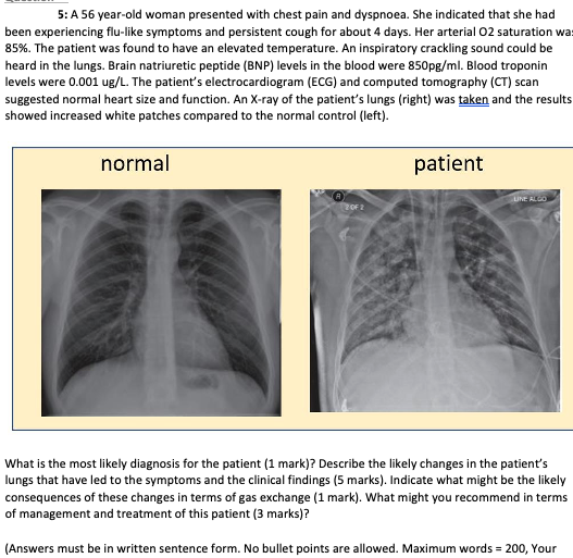 5 A 56 Year Old Woman Presented With Chest Pain And Dyspnoea She Indicated That She Had Been Experiencing Flu Like Sym 1