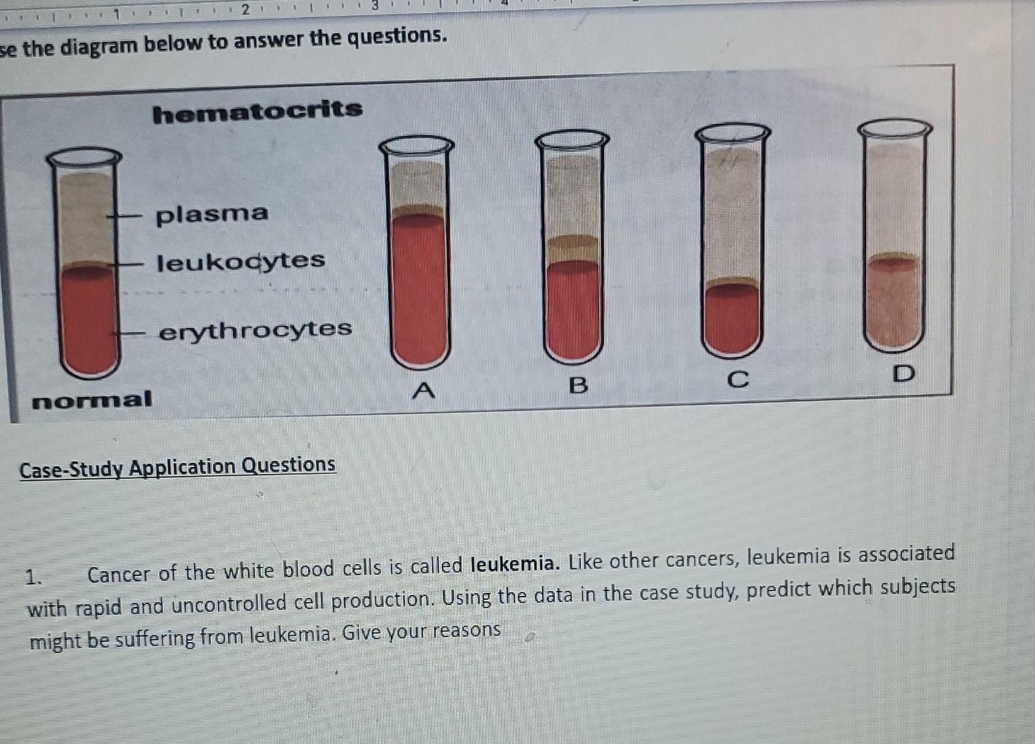 1 2 3 Se The Diagram Below To Answer The Questions Hematocrits Plasma Leukocytes Erythrocytes Normal A B C D Case Stud 1