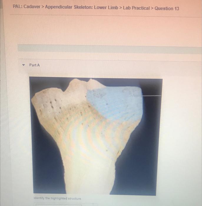 Pal Cadaver Appendicular Skeleton Lower Limb Lab Practical Question 13 Part A Identify The Highlighted Structur 1