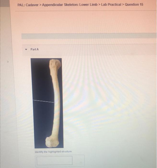 Pal Cadaver Appendicular Skeleton Lower Limb Lab Practical Question 15 Y Part A Identify The Highlighted Structur 1