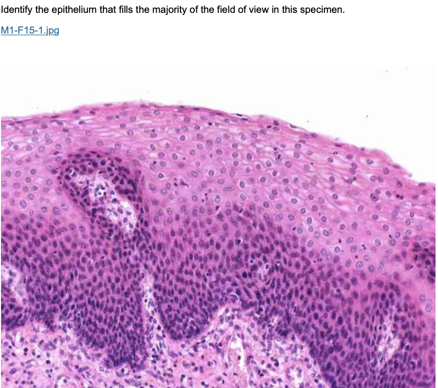 Identify The Epithelium That Fills The Majority Of The Field Of View In This Specimen M1 F15 1 Jpg 1