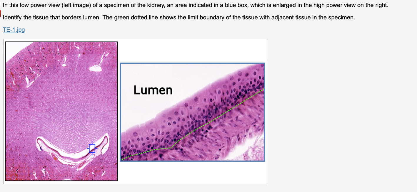 In This Low Power View Left Image Of A Specimen Of The Kidney An Area Indicated In A Blue Box Which Is Enlarged In T 1