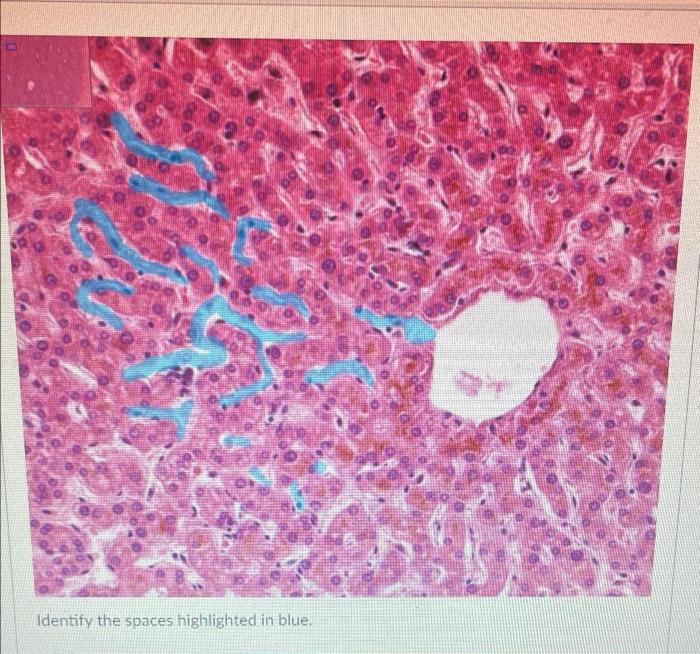 Identify The Spaces Highlighted In Blue Any 1