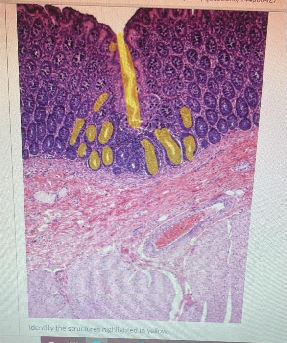 38 Identify The Structures Highlighted In Yellow 1