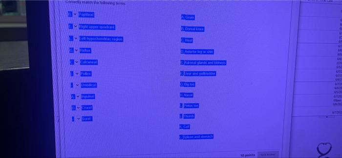 Conectly Match The Flowing Terms Oplinal Right Uppe Quadrant Left Hypochondriac Region Calcaneal Polit Untilical Inspina 2