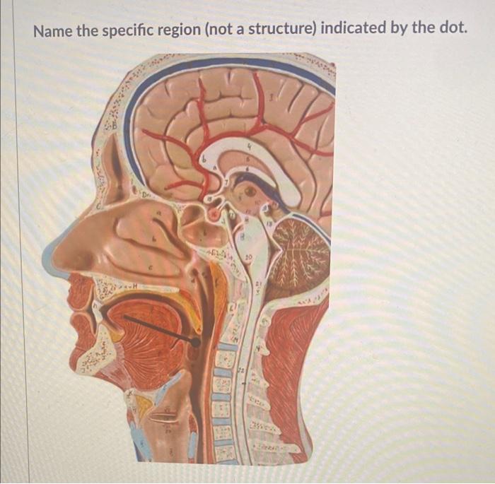 Name The Specific Region Not A Structure Indicated By The Dot 20 Wew 1