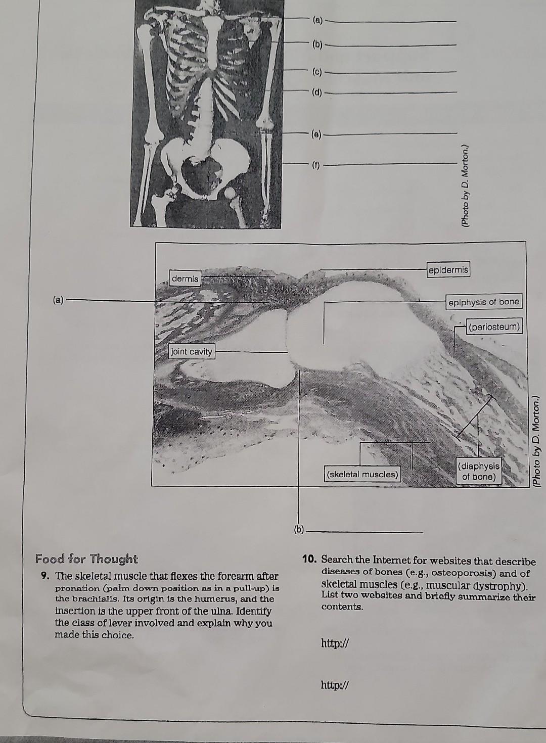 Dermis A Joint Cavity Food For Thought 9 The Skeletal Muscle That Flexes The Forearm After Pronation Palm Down Posit 1