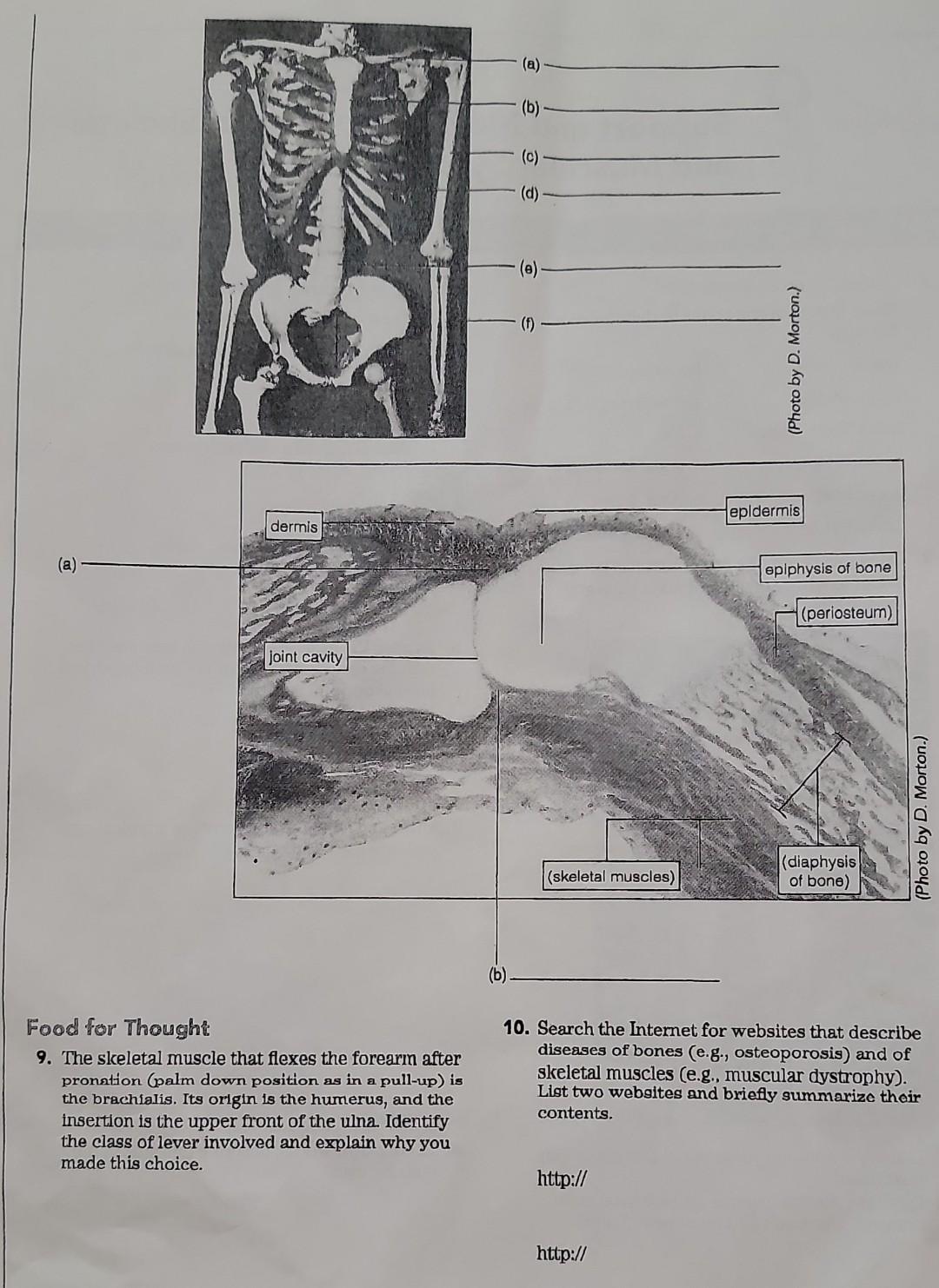 Dermis A Joint Cavity Food For Thought 9 The Skeletal Muscle That Flexes The Forearm After Pronation Palm Down Posit 3