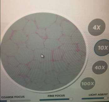 Upload Your Photo That Clearly Points Out Your Chosen Adipose Cell Under The 10x Objective Lens Determine The Size Of T 2