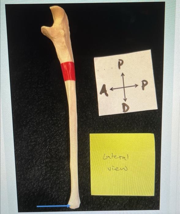 P P D Lateral View Library Home Students Identify The Structure That Is Flagged By The Blue Arrow In The Image Above 1
