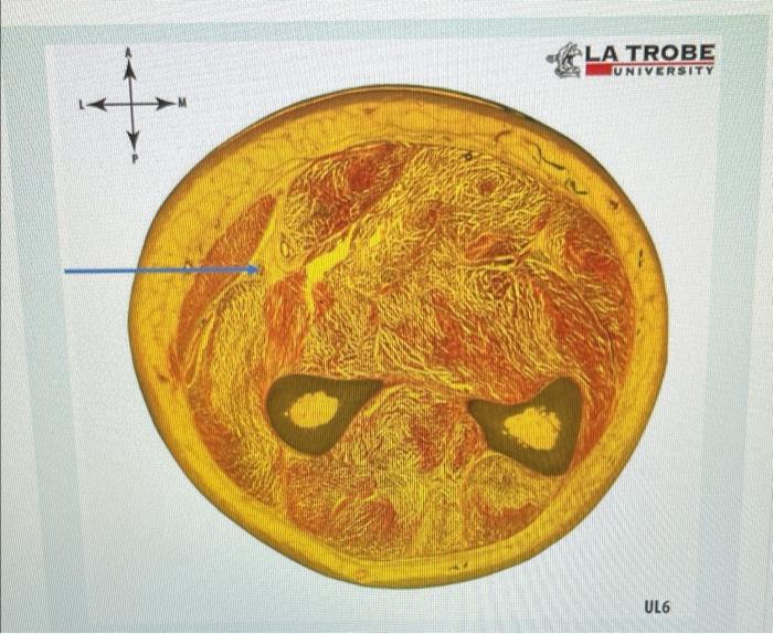 La Trobe University Ul6 Identify The Structure That Is Flagged By The Blue Arrow In The Image Above The Flagged Struct 1