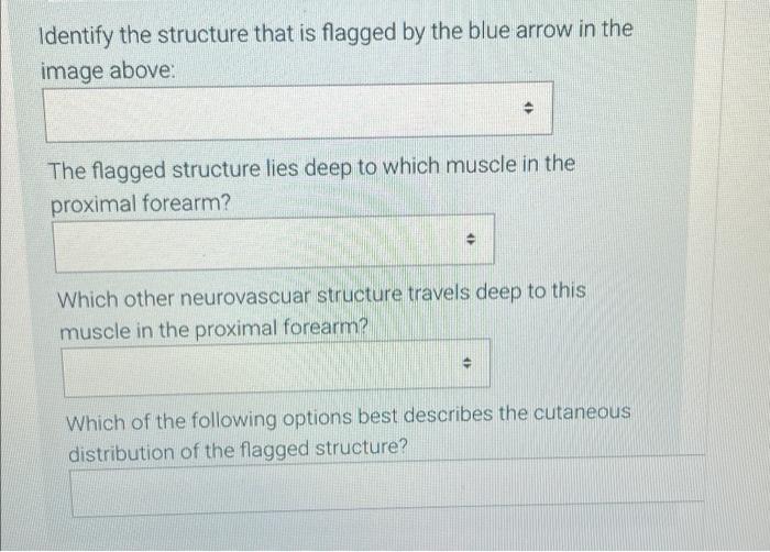 La Trobe University Ul6 Identify The Structure That Is Flagged By The Blue Arrow In The Image Above The Flagged Struct 2