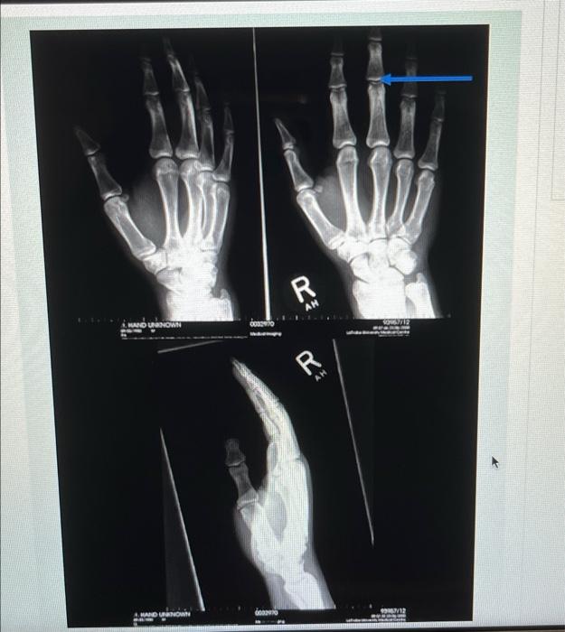 Unknown Hand Unknown 0032970 R Ah R Ah Son67 12 19167 12 Selende Identify The Joint That Is Flagged By The Blue Arrow I 1