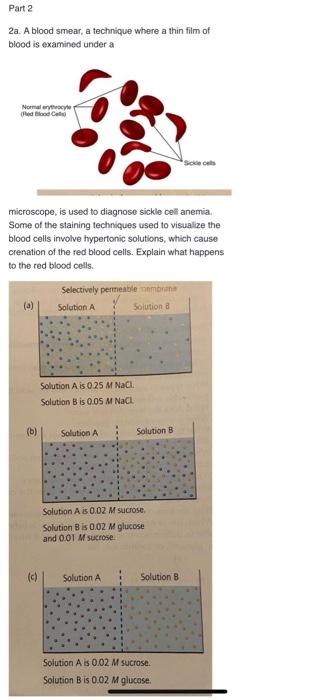 Part 2 2a A Blood Smear A Technique Where A Thin Film Of Blood Is Examined Under A Normalerwe Fed Loodud Sodels Micros 1