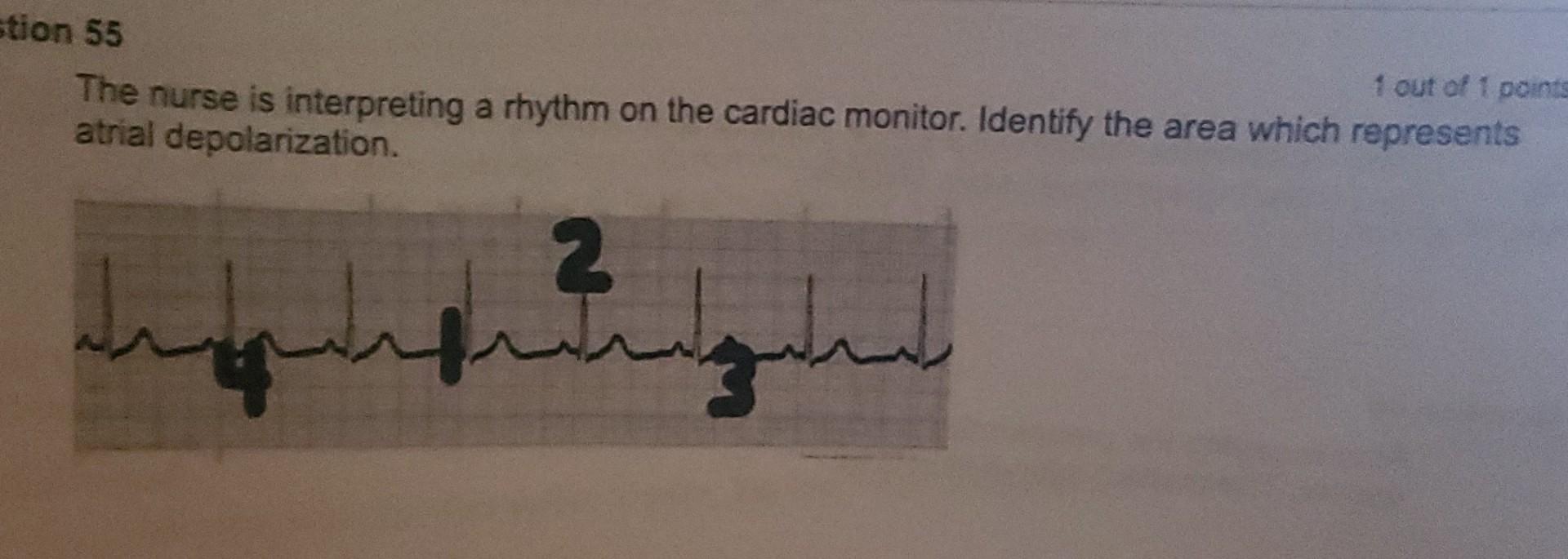 Stion 55 1 Out Of 1 Points The Nurse Is Interpreting A Rhythm On The Cardiac Monitor Identify The Area Which Represents 1