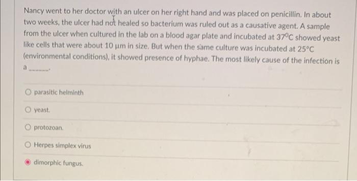 Which Of The Following Is The Best Example Of Commensalism Lactobacillus Acidophilus Inhibiting Other Bacteria And Prev 2