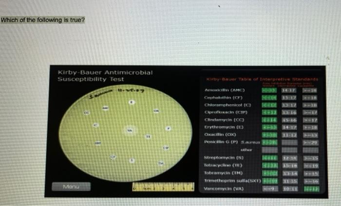 Which Of The Following Is True Kirby Bauer Antimicrobial Susceptibility Test Kirbyer Table Of Interpretive Standards A 1