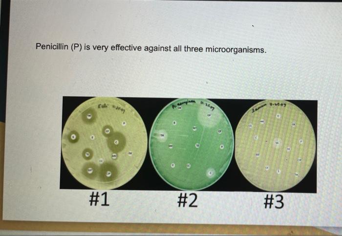 Which Of The Following Is True Kirby Bauer Antimicrobial Susceptibility Test Kirbyer Table Of Interpretive Standards A 2
