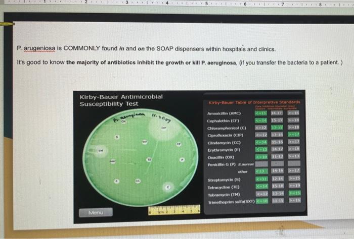 Which Of The Following Is True Kirby Bauer Antimicrobial Susceptibility Test Kirbyer Table Of Interpretive Standards A 3