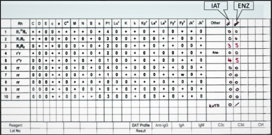 The Goal In Testing A Sample With A Suspected Warm Autoantibody Is To Determine Whether An Underlying Alloantibody Exist 3
