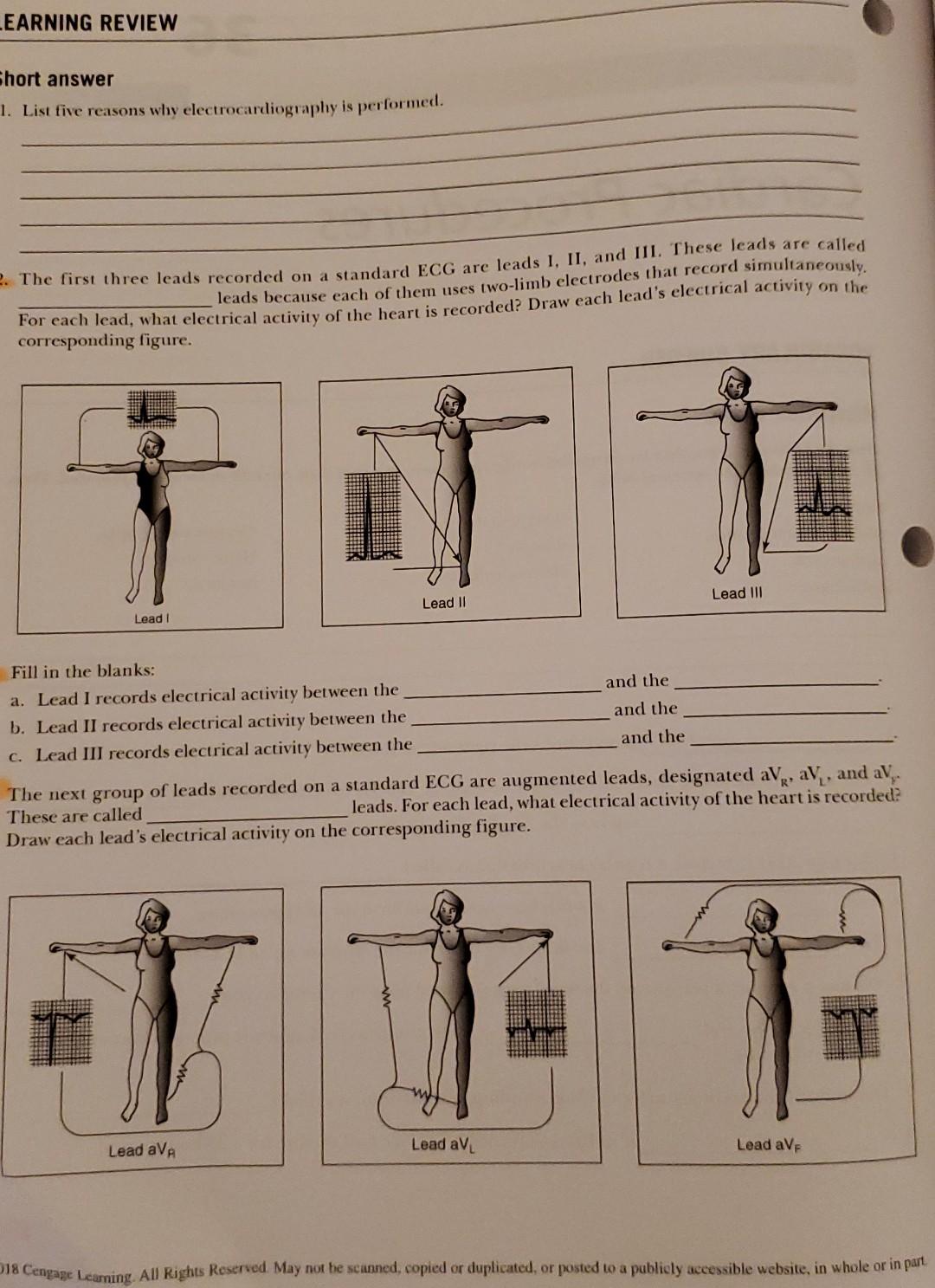 Learning Review Short Answer 1 List Five Reasons Why Electrocardiography Is Performed 2 The First Three Leads Recorde 1