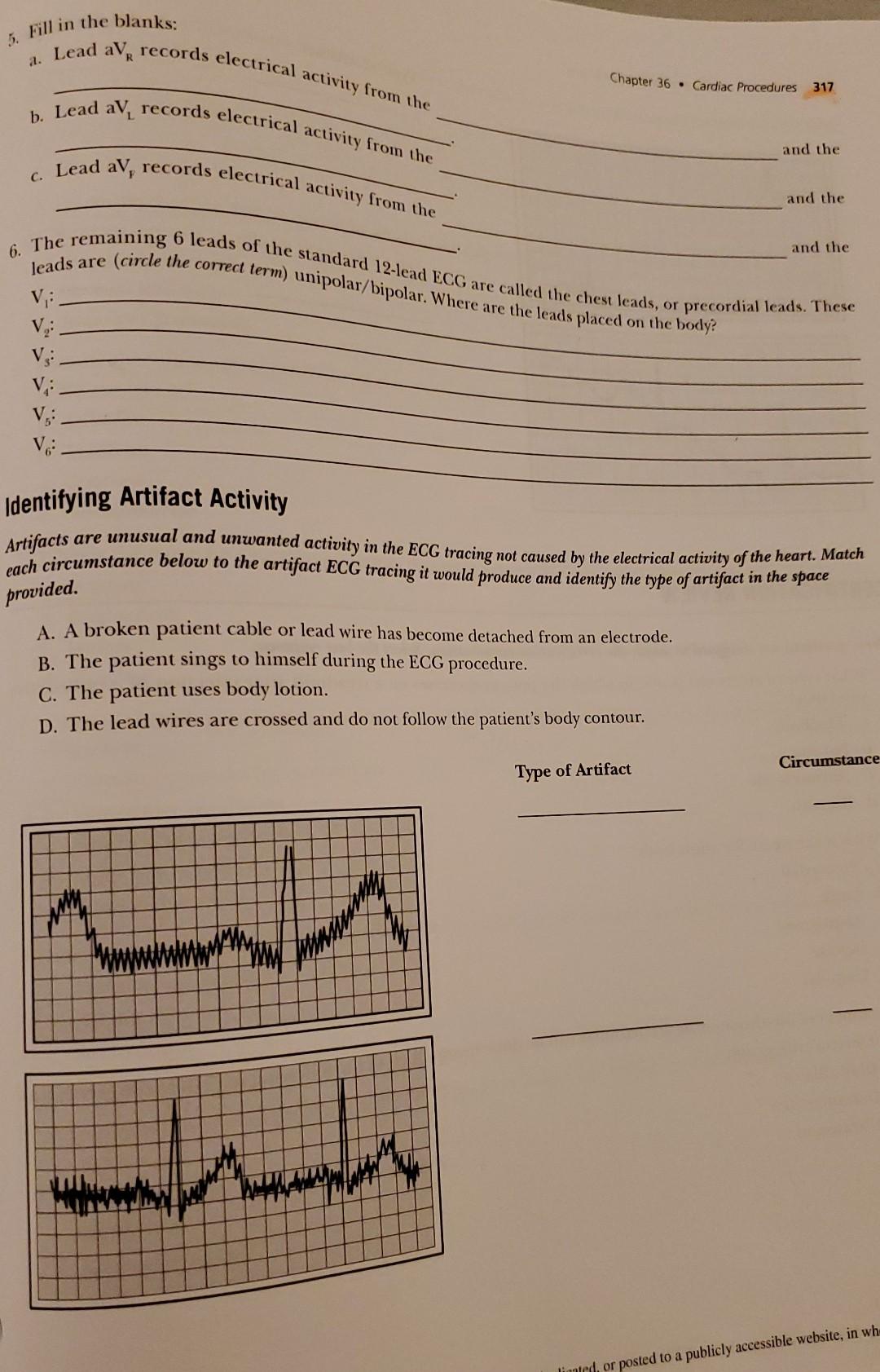 5 Fill In The Blanks Lead Av Records Electrical Activity From The 2 Chapter 36 Cardiac Procedures 317 B Lead Av R 1