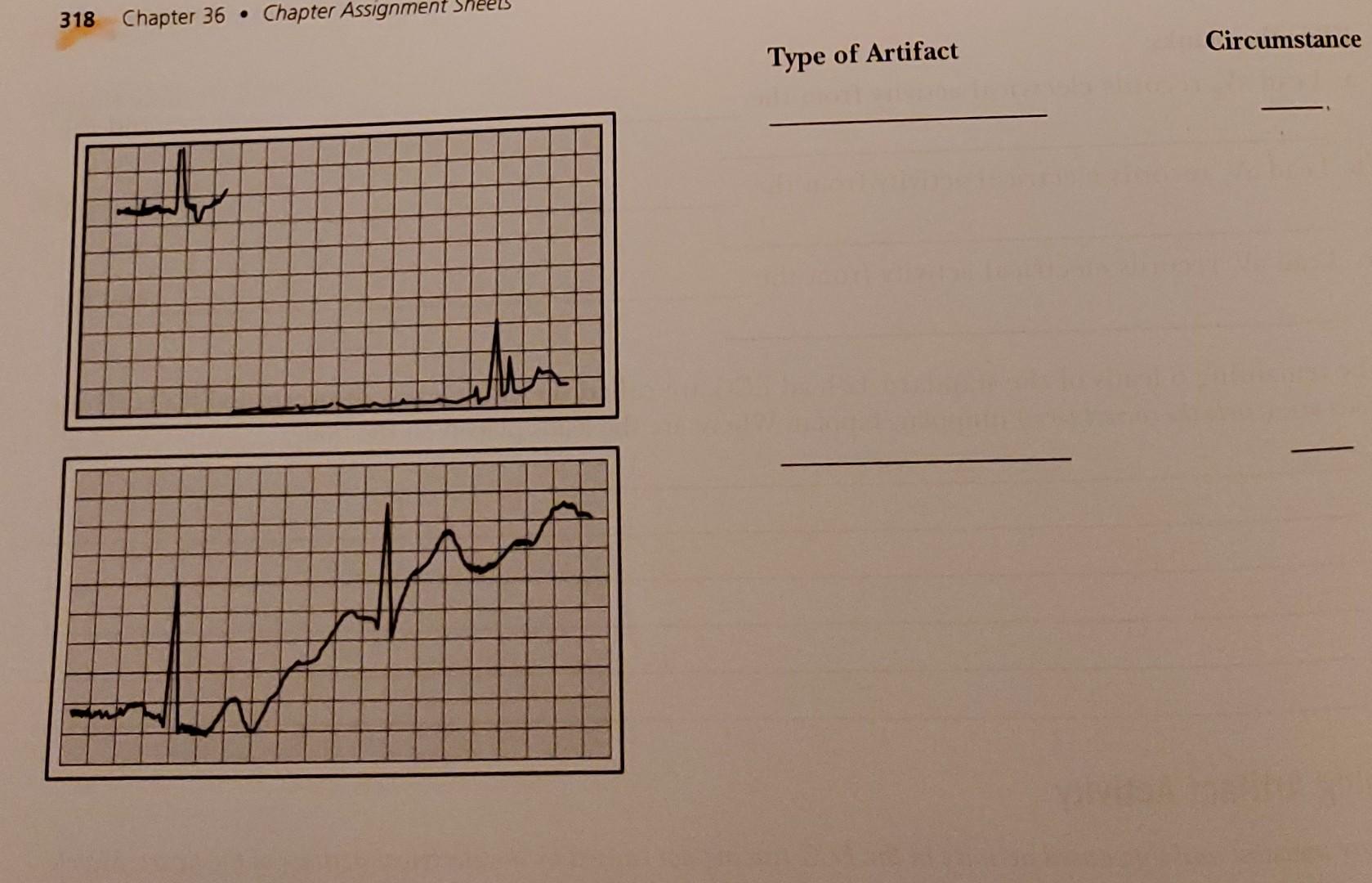 5 Fill In The Blanks Lead Av Records Electrical Activity From The 2 Chapter 36 Cardiac Procedures 317 B Lead Av R 2