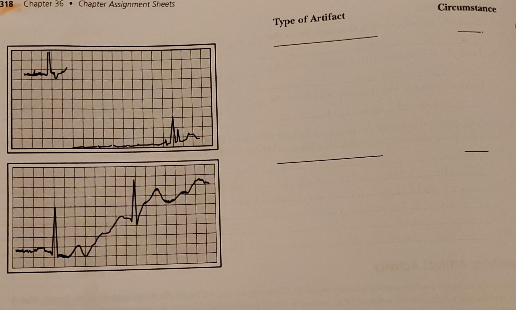 Prisk Auxiliary Line Identifying Artifact Activity Left Midauxiliary Line Are Artifacts Provided Unusual And Unwanted A 2