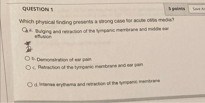 Question 1 5 Points Save Ar Which Physical Finding Presents A Strong Case For Acute Otitis Media Ca Bulging And Retrac 1