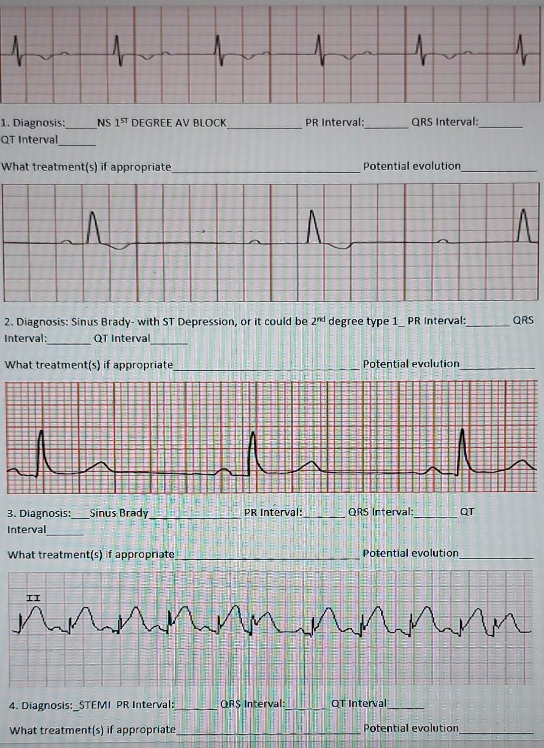 1 4 Ns 1st Degree Av Block Pr Interval Qrs Interval 1 Diagnosis Qt Interval What Treatment S If Appropriate Potenti 1