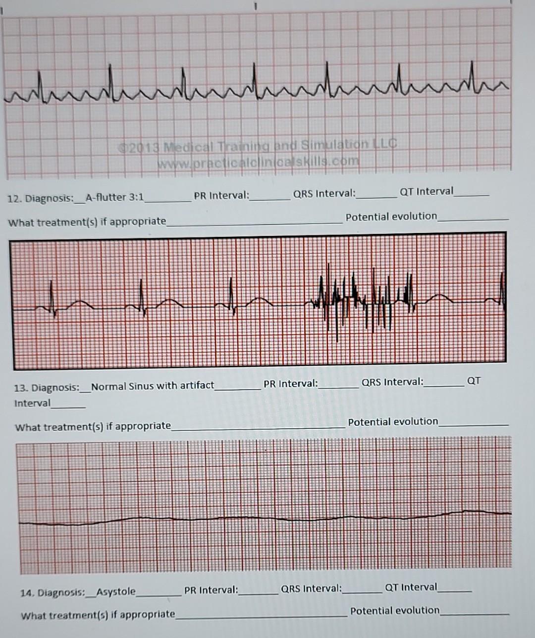 Whenhunkumhudhuhuhu 2013 Medical Training And Simulation Llc Www Practical Cel Skills Com Pr Interval Qrs Interval 12 1
