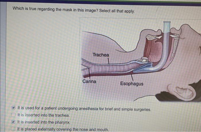 Which Is True Regarding The Mask In This Image Select All That Apply Trachea Carina Esophagus It Is Used For A Patient 1