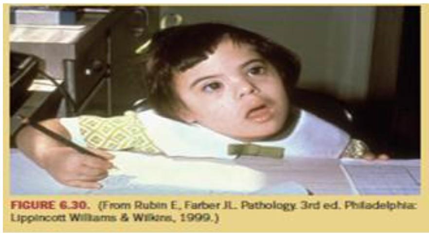 Your Next Patient Is Kaylee The Little Girl You See In This Picture Fig 6 30 She Has Been Playing Quietly With A Pe 1