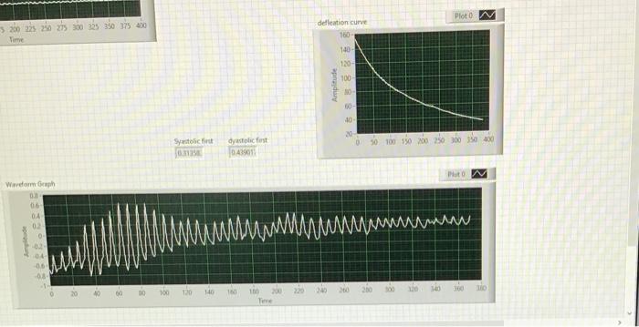 Plot 0 M 3200225 250 275 300 325 350 375430 Time Dellation Curve 180 140 120 100 Ampude 08 10 02 Systolic 019 Dystolic F 1