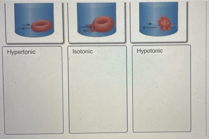 A Semipermeable Membrane Is Placed Between The Following Solutions Which Solution Will Decrease In Volume View Avail 4