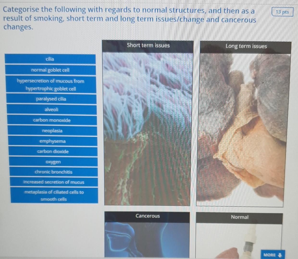 Watch The Following Etiologies To Their Definition 5 Pts Genetic Infectious Agent Unknown Cause Microbial Cause Inherit 4