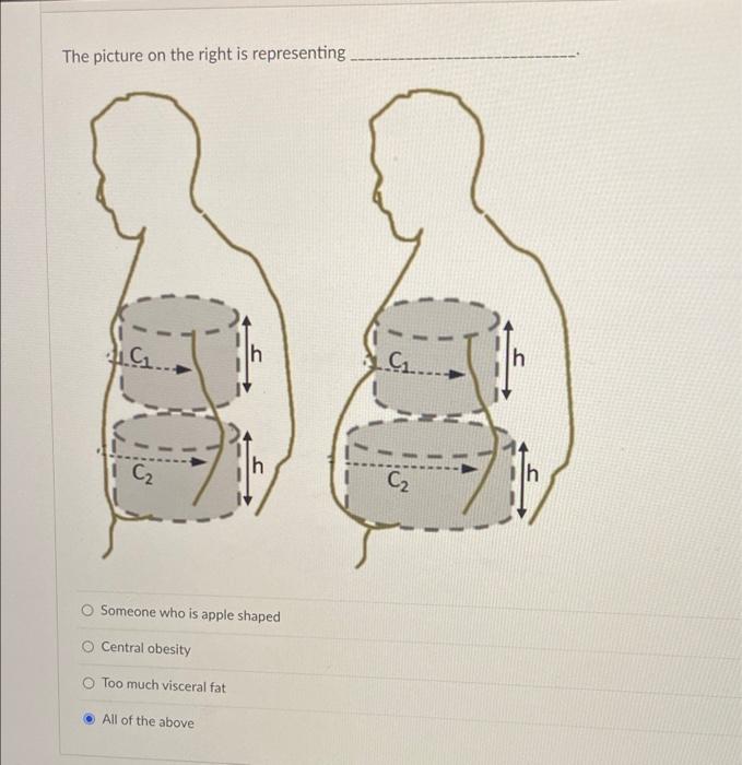 The Picture On The Right Is Representing G H C H H C2 Someone Who Is Apple Shaped Central Obesity Too Much Visceral Fa 1