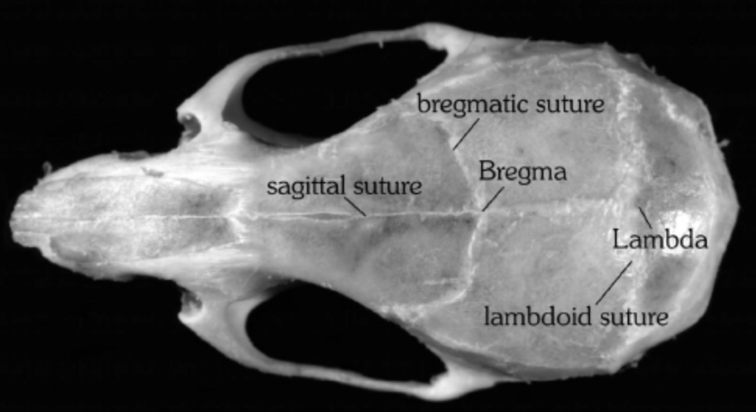 Bregmatic Suture Bregma Sagittal Suture Lambda Lambdoid Suture 1