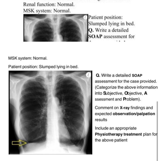 Renal Function Normal Msk System Normal Patient Position Slumped Lying In Bed Jq Write A Detailed Soap Assessment 1