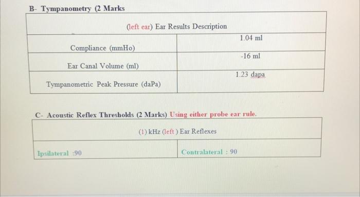The Pure Tone Audiometey Reveald Normal Hearing Thresholds 2