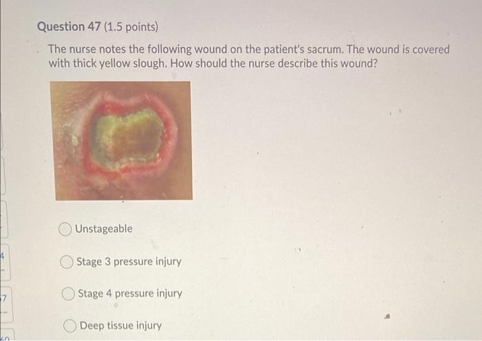 Question 45 1 5 Points The Nurse Has Taught A Patient Measures To Avoid Complications Associated With Urinary Eliminat 3