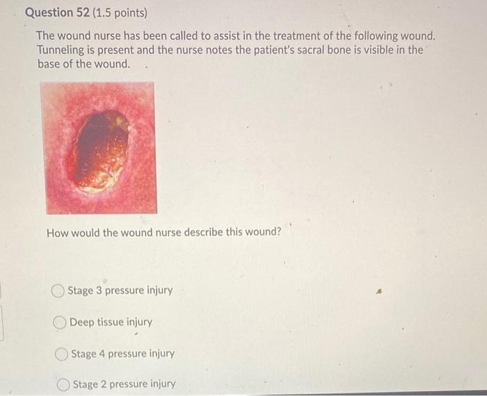 Question 51 1 5 Points A Patient S Wound Is Healing By Secondary Intention During The Dressing Change The Patient As 2