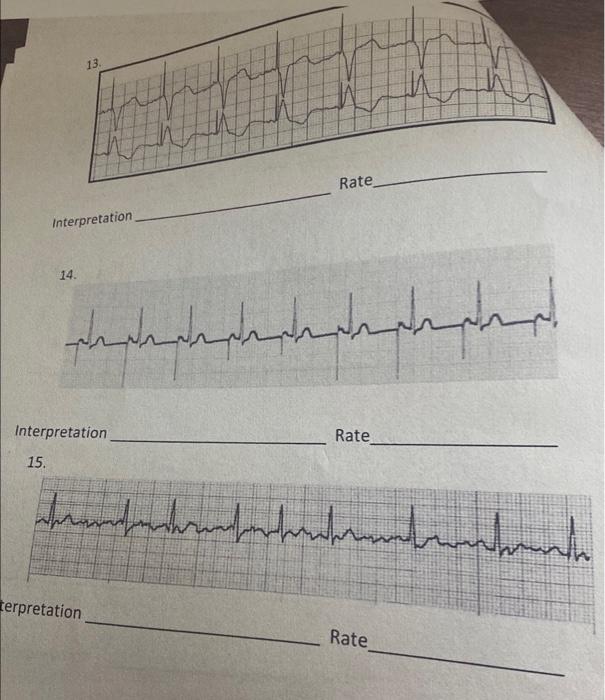 13 Rate Interpretation 14 Manbaladora Abandonado Interpretation Rate 15 Dermahadhranfondenbranden Terpretation Rate 1