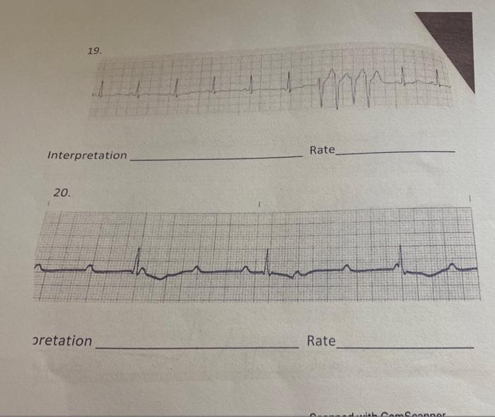 13 Rate Interpretation 14 Manbaladora Abandonado Interpretation Rate 15 Dermahadhranfondenbranden Terpretation Rate 2
